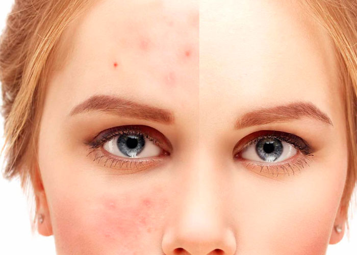 При высыпаниях на коже При высыпаниях на коже